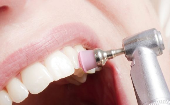 Pulizia dei denti professionale: cos’è e ogni quanto andrebbe svolta