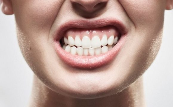 Malocclusione dentale: sintomi e pericoli di un disturbo trattabile