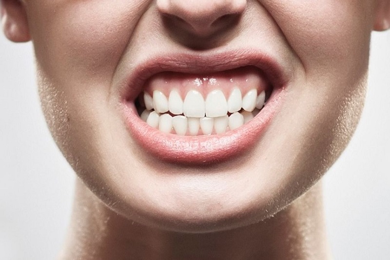 Malocclusione dentale: sintomi e pericoli di un disturbo trattabile