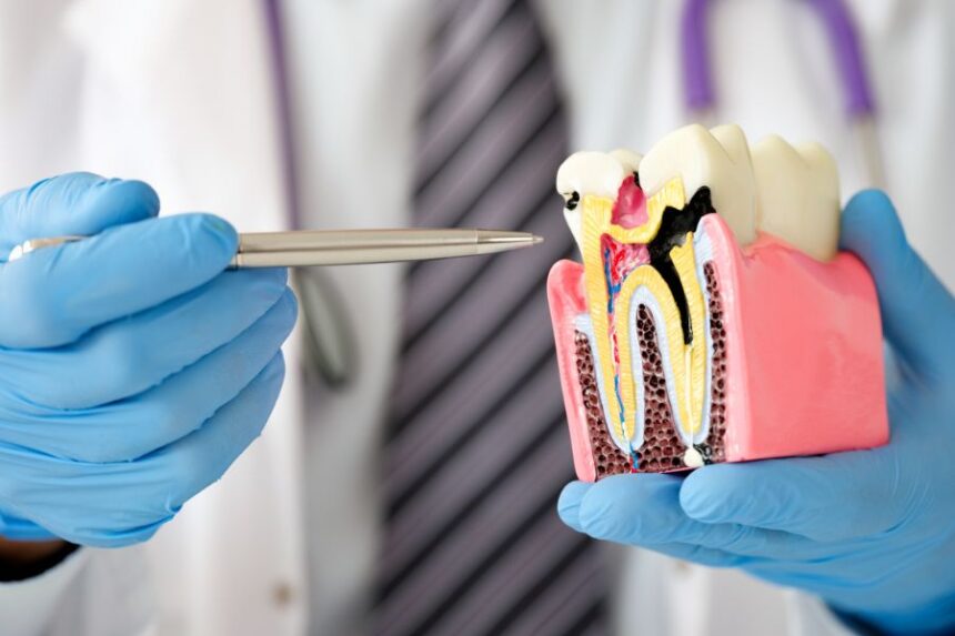 Carie dentali: come prevenirle con i consigli giusti