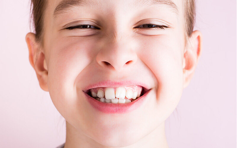 Affollamento dentale: cause e rimedi